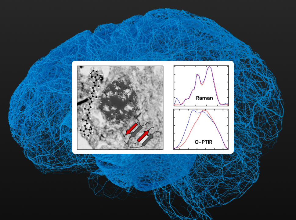 Novel Insights into Cartenoid Association with Amyloid Aggregates in Brain Tissue