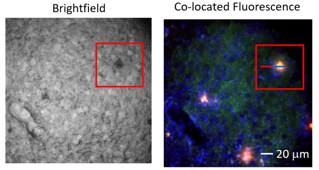 Insights into protein aggregation