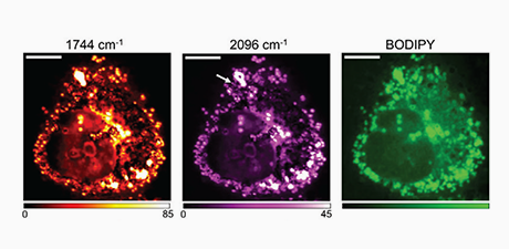 Single-cell mapping of lipid metabolites using an infrared probe in human derived model systems nature communications