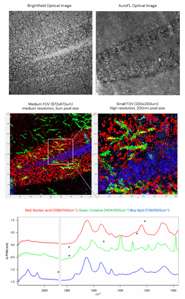 Tissue imaging and protein aggregation