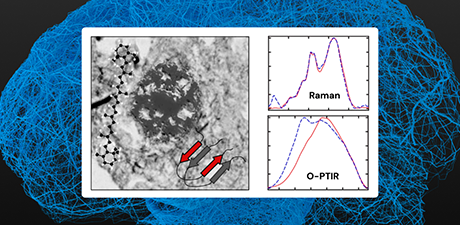 Join a two-part webinar exploring how submicron IR (O-PTIR) and Raman imaging are used to study the co-localization of amyloid β aggregates and carotenoids in human brain tissue, offering insights into Alzheimer’s Disease progression.