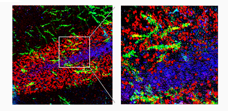 How submicron IR (O-PTIR) spectroscopy and imaging is advancing neurodegenerative disease research