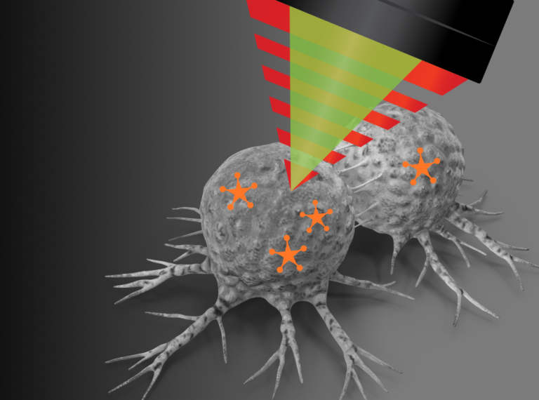 Simultaneous submicron IR + SERS imaging for cancer cell classification