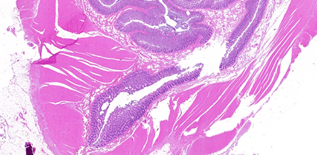 microplastics in human formalin-fixed paraffin-embedded tissue sections