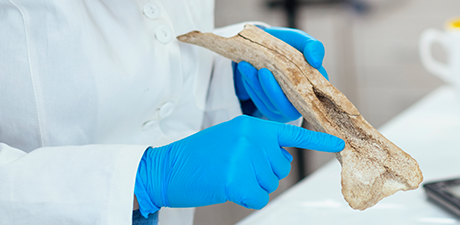Assessment of submicron bone tissue composition in plastic-embedded samples using optical photothermal infrared (O-PTIR) spectral imaging and machine learning
